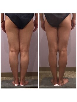 ナレル(narrel)/(新潟市/骨盤/痩身/ダイエット)