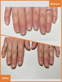 ワイ(Y)/ネイルケア