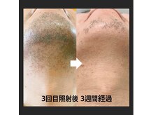 サンスタイルクリア 守山店(SUN STYLE CLEAR)