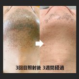 サンスタイルクリア 守山店(SUN STYLE CLEAR)