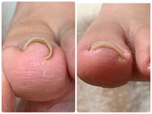 リネイル 長浜(Re-na-iL)の雰囲気（フットネイルや巻爪、トラブル爪にも力を入れております）