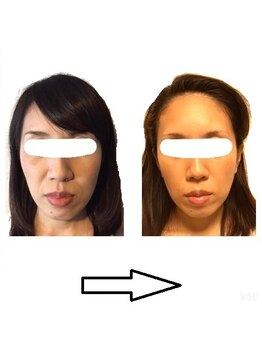 かんだ接骨院/美顔小顔EMS（30分）