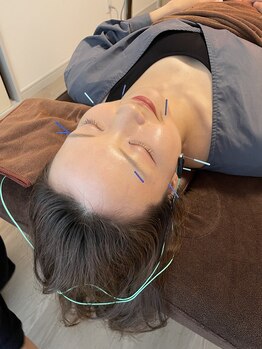 ハリファ鍼灸院 横浜関内院(HariFa鍼灸院)/美容鍼