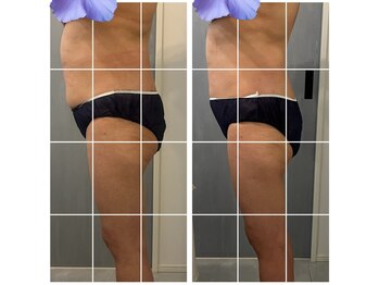 美温(mion)/お腹周りは本気痩身