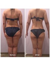 ナレル(narrel)/(新潟市/骨盤/痩身/ダイエット)