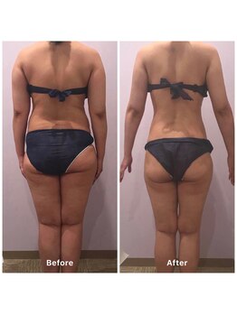 ナレル(narrel)/(新潟市/骨盤/痩身/ダイエット)