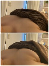 スマイルクルー(SmileClue)/初回ビフォーアフター症例