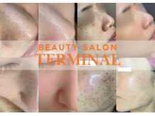 ターミナルジム アンド ビューティーサロン(TERMINAL GYM&BEAUTY SALON)