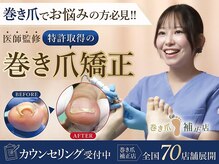 巻き爪補正店　豊橋店【巻き爪・魚の目・角質・副爪】【5月上旬オープン（予定）】の雰囲気（医師監修の巻き爪補正店。痛みが少ない・切らない巻き爪ケア）