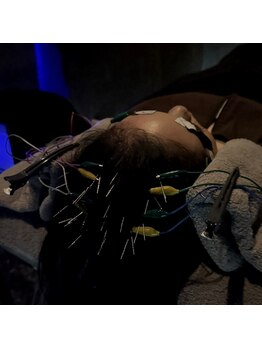 脳疲労・睡眠専門鍼灸院 NEL銀座店<不眠・頭痛・肩こり・ヘッドマッサージ>/微弱電流が心地よい眠りへ