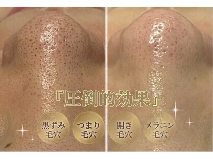 リサロン エヌ(Re salon N)の写真