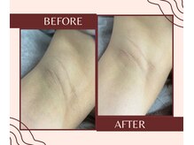 パールプラス 大村店(Pearl plus)/美肌メニューも充実☆