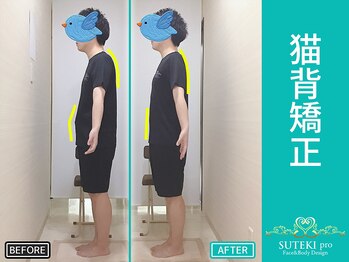 美骨矯正 ステキプロ(SUTEKI pro)/ストレートネック・巻肩・姿勢