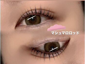 シュピネ(Choupinet)/◯マシュマロロッド◯