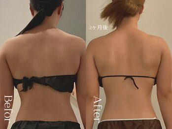 ユーフォリア グロウ(euphoria glow)/{ ラフォス痩身90分 10回 }