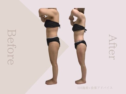 レミューの写真