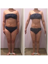 ナレル(narrel)/(新潟市/骨盤/痩身/ダイエット)