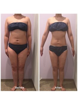 ナレル(narrel)/(新潟市/骨盤/痩身/ダイエット)