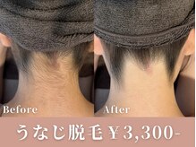 ダリア(DAHLIA)の雰囲気（最先端マシンを使用したハイパワー脱毛！安心の都度払い制も◎）