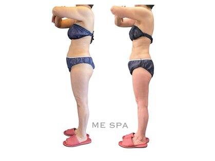 ミースパ(ME SPA)の写真