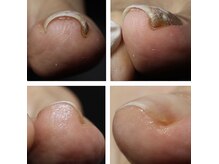 ネイルルーム ファンデーション(Nail Room FOUNDATION)の雰囲気（JTNC認定のトラブルネイルケアリストに爪カットお任せ下さい。）