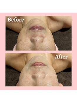 グロウ トータルビューティデザイン(GLOW TOTAL BEAUTY DESIGN)/復元パック