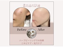 アイル 博多祇園店(iru)/