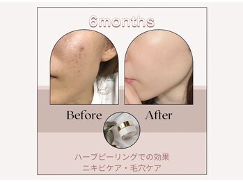 アイル 博多祇園店(iru)/