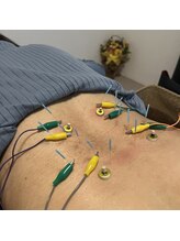 マル(malu)/鍼灸施術