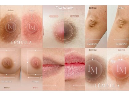 ジジベレッザ 大阪中崎町店(jiji belleza)の写真