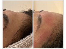 美しぐれ 溝の口店/【1ヶ月(2回)】LDM/インモード