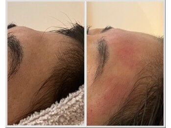 美しぐれ 溝の口店/【1ヶ月(2回)】LDM/インモード