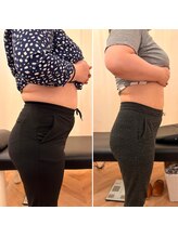 ナオ接骨院(NAO接骨院)/Before／After