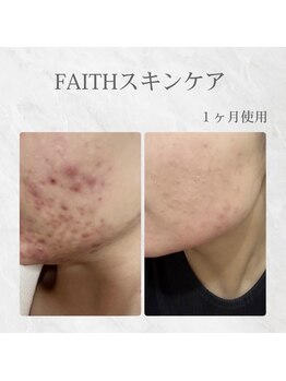 LiNOA./FAITHスキンケア×サロンケア