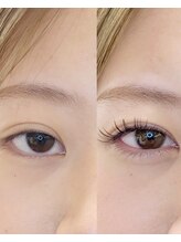 エイト(eight)/束感ダブルフラット120本