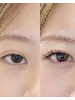 エイト(eight)/束感ダブルフラット120本