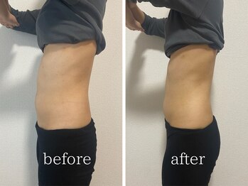 サンク(Cinq)/【デトックス腸もみ】腸不調改善