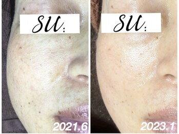 スー(su:)/見た目だけではなく手触りも変化