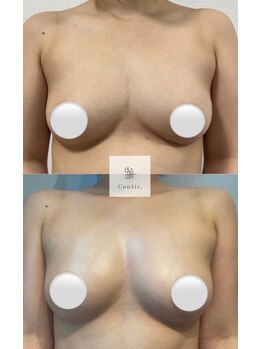 エルミナ.(elmina.)/全体的にボリュームアップ！