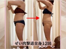 ハナチュチュ 矢場町店(Hanachuchu)/