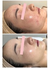 ピオニー(peony)/