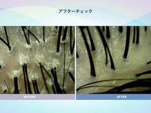 アンス(anth:)/お客様の仕上がり