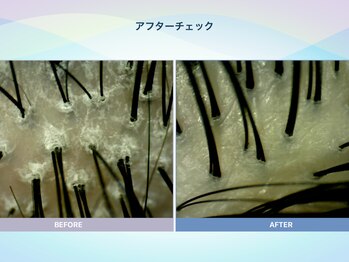 アンス(anth:)/お客様の仕上がり