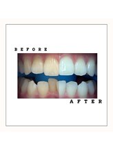 セルフダック 会津若松店(SELFDUCK)/BeforeAfter