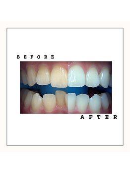 セルフダック 会津若松店(SELFDUCK)/BeforeAfter