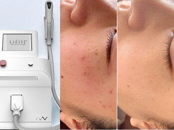 ミーツ(Meets)の写真/鏡を見るたび気になるシミにアプローチ！変化を実感できるケアを届けます。一人で悩まず、あきらめないで。