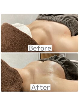 リリーパッソ(Lily passo)/