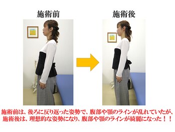 やぎはし整体院 柏駅東口店/姿勢ビフォーアフター