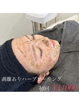 スナチュラル(Snatural)/韓国式剥離ハーブピーリング