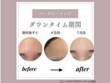 アイル 博多祇園店(iru)/